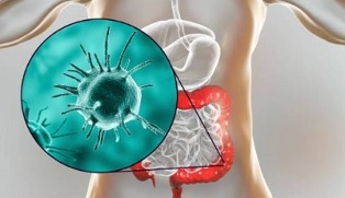 what tests to pass for parasites