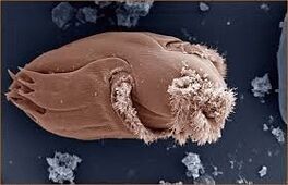Pathogenic microorganisms in humans