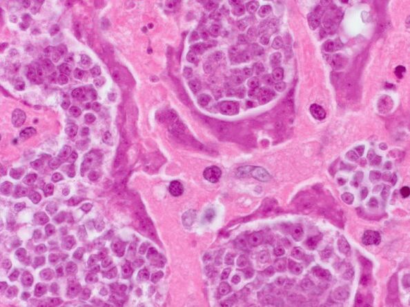 Study of parasites in a person