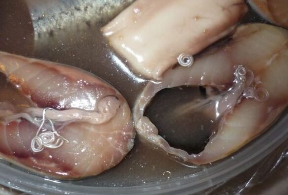 Ways of human infection by parasites