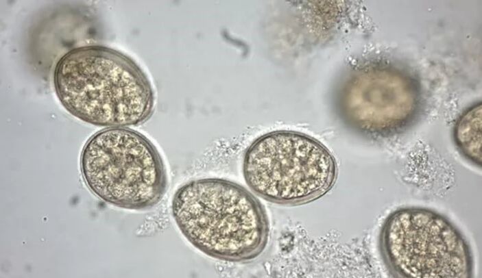 parasites under the microscope