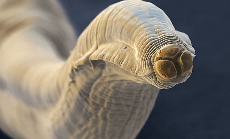 worm parasite from the human body